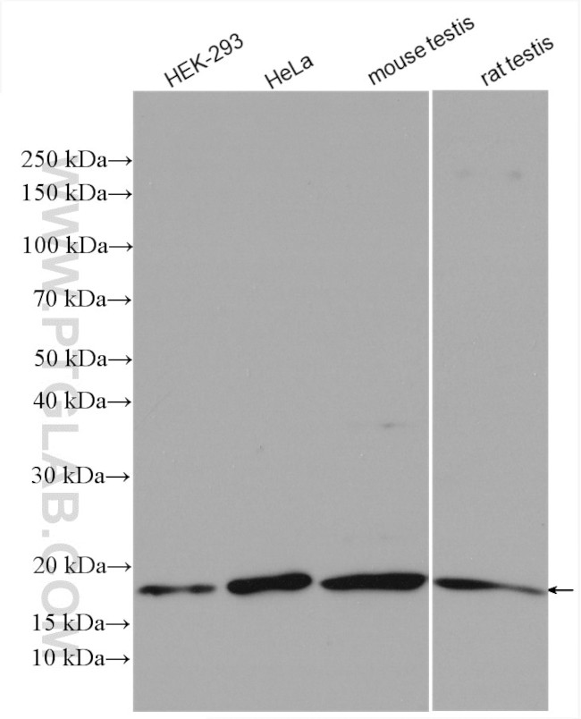 UBC9 Antibody in Western Blot (WB)