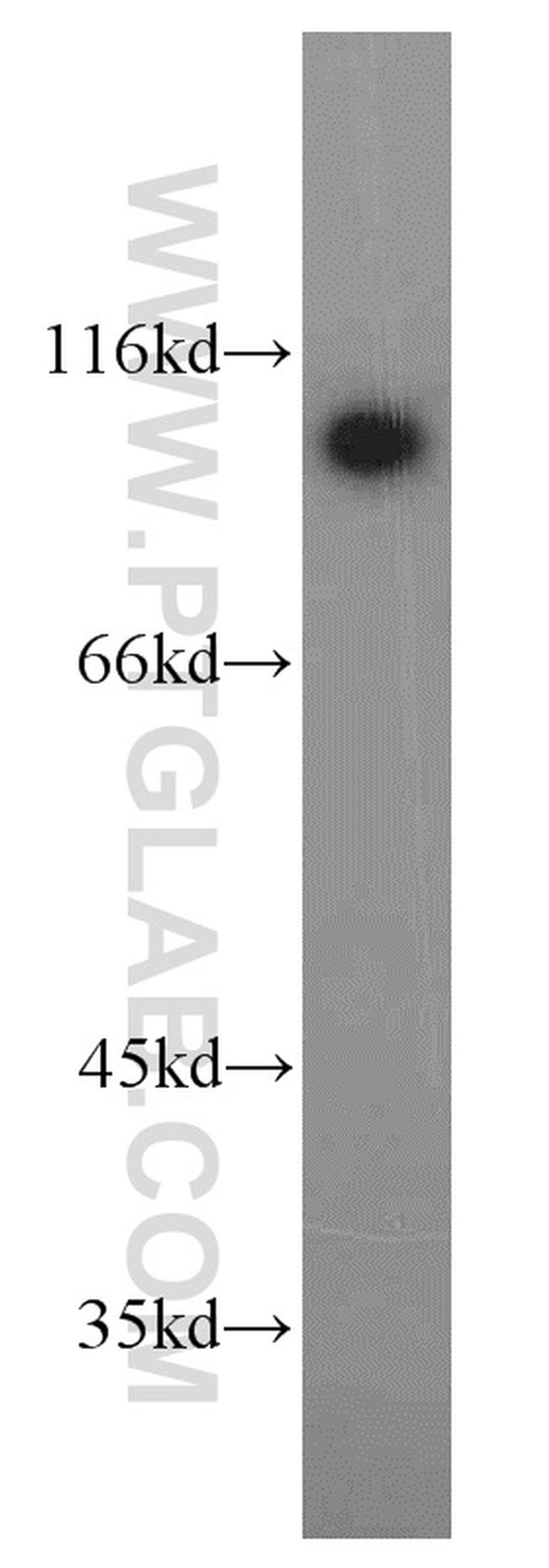 ELAC2 Antibody in Western Blot (WB)