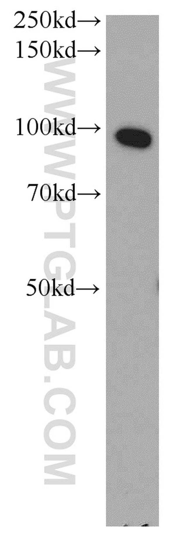 ELAC2 Antibody in Western Blot (WB)