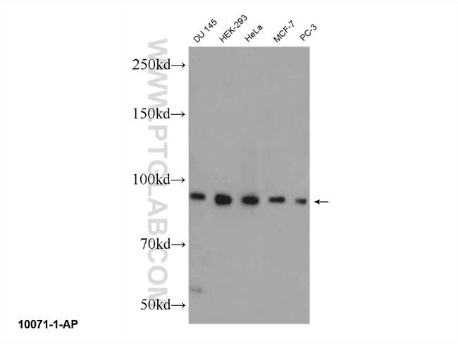 ELAC2 Antibody in Western Blot (WB)