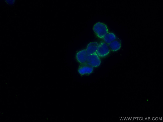 Recoverin Antibody in Immunocytochemistry (ICC/IF)