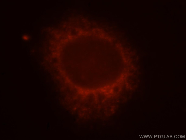 Recoverin Antibody in Immunocytochemistry (ICC/IF)