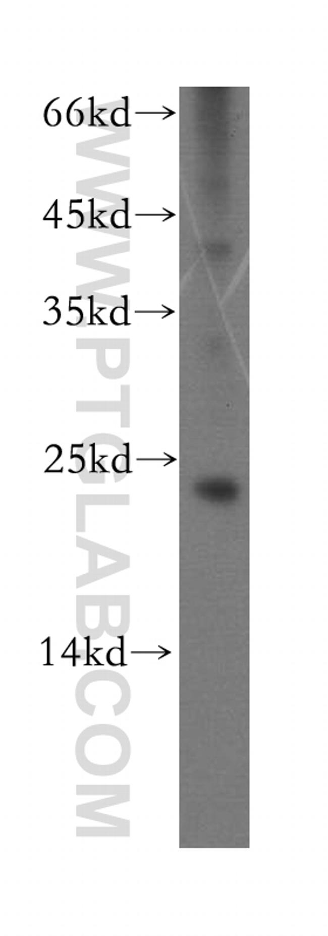 Recoverin Antibody in Western Blot (WB)