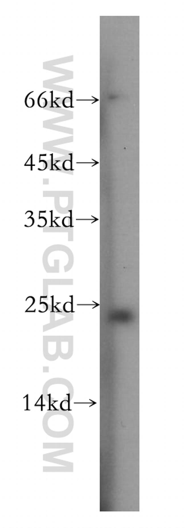 Recoverin Antibody in Western Blot (WB)