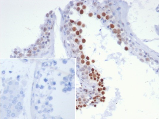 NUT1/NUTM1/Snurportin 1 Antibody in Immunohistochemistry (Paraffin) (IHC (P))