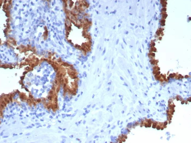 PTPRU Antibody in Immunohistochemistry (Paraffin) (IHC (P))