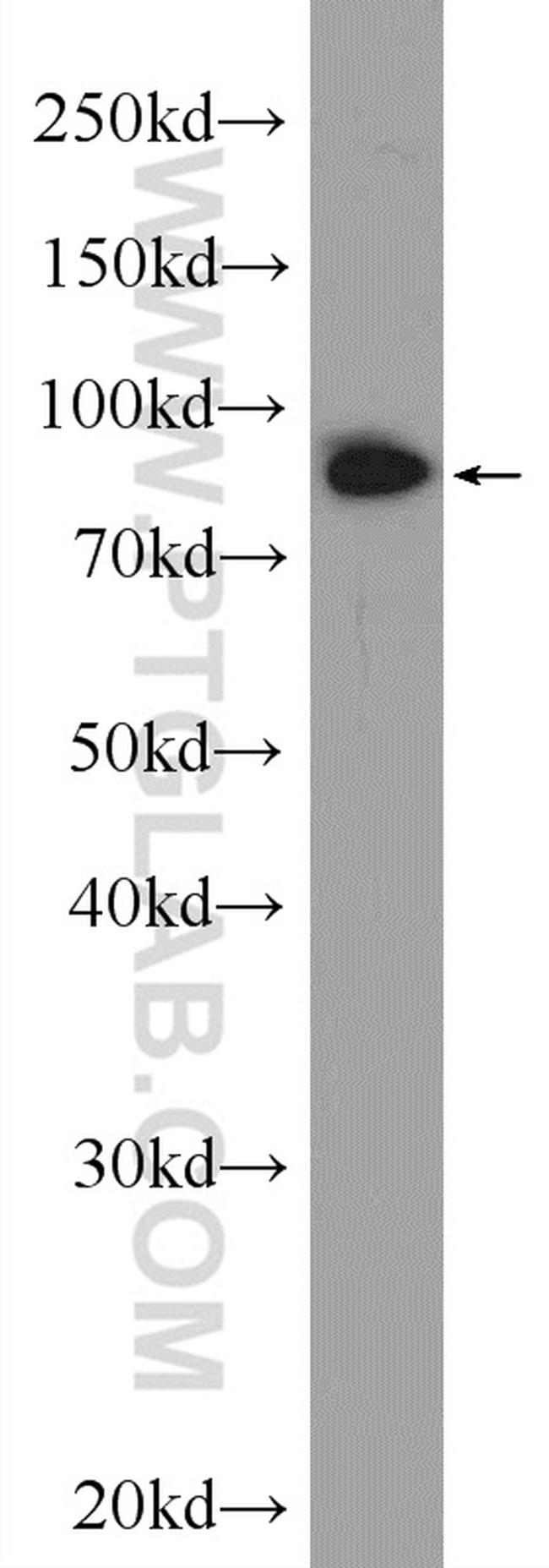 Importin beta Antibody in Western Blot (WB)