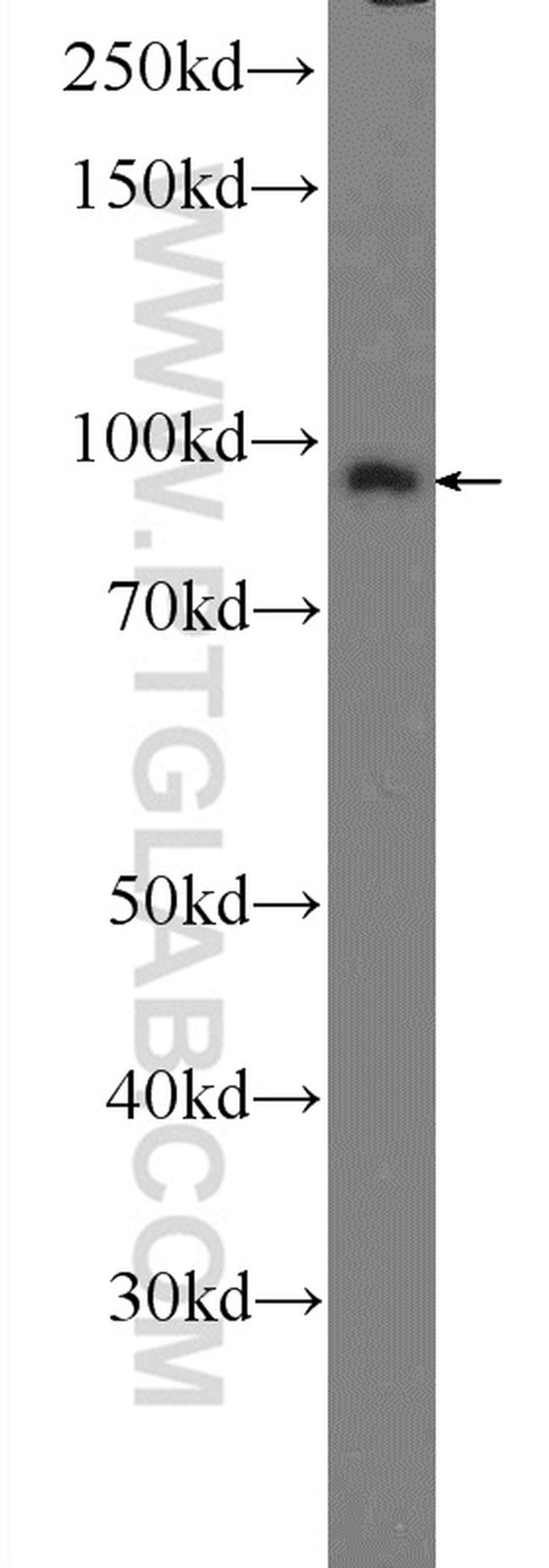 Importin beta Antibody in Western Blot (WB)