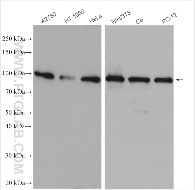 Importin beta Antibody in Western Blot (WB)