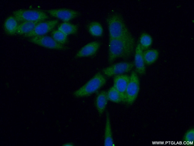 PKM Antibody in Immunocytochemistry (ICC/IF)