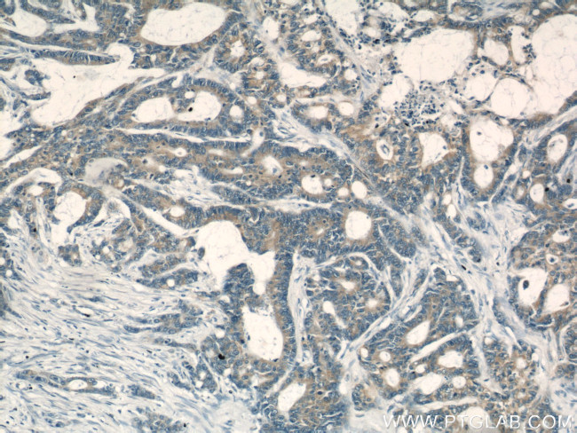 PKM Antibody in Immunohistochemistry (Paraffin) (IHC (P))