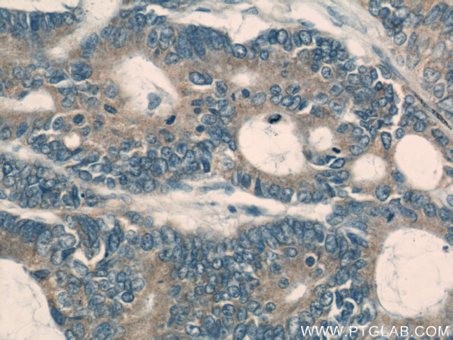 PKM Antibody in Immunohistochemistry (Paraffin) (IHC (P))