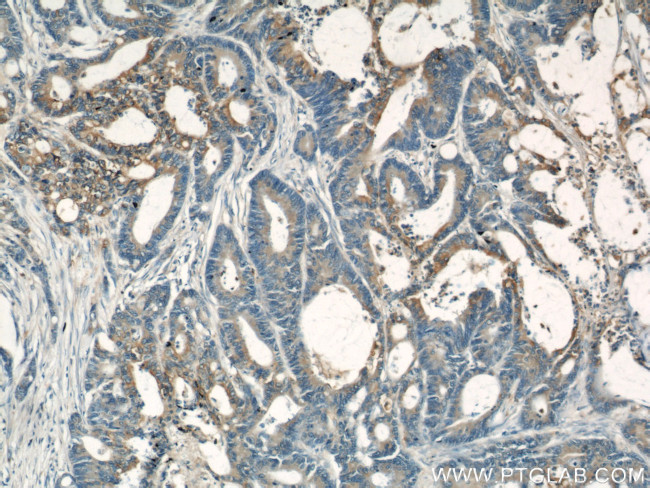 PKM Antibody in Immunohistochemistry (Paraffin) (IHC (P))