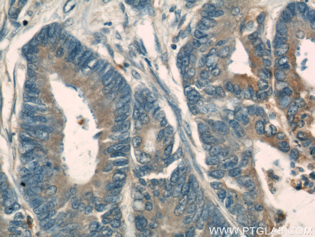 PKM Antibody in Immunohistochemistry (Paraffin) (IHC (P))