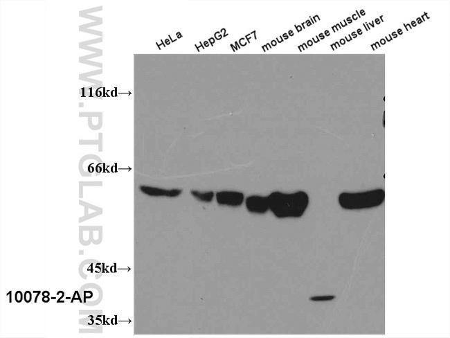 PKM Antibody in Western Blot (WB)