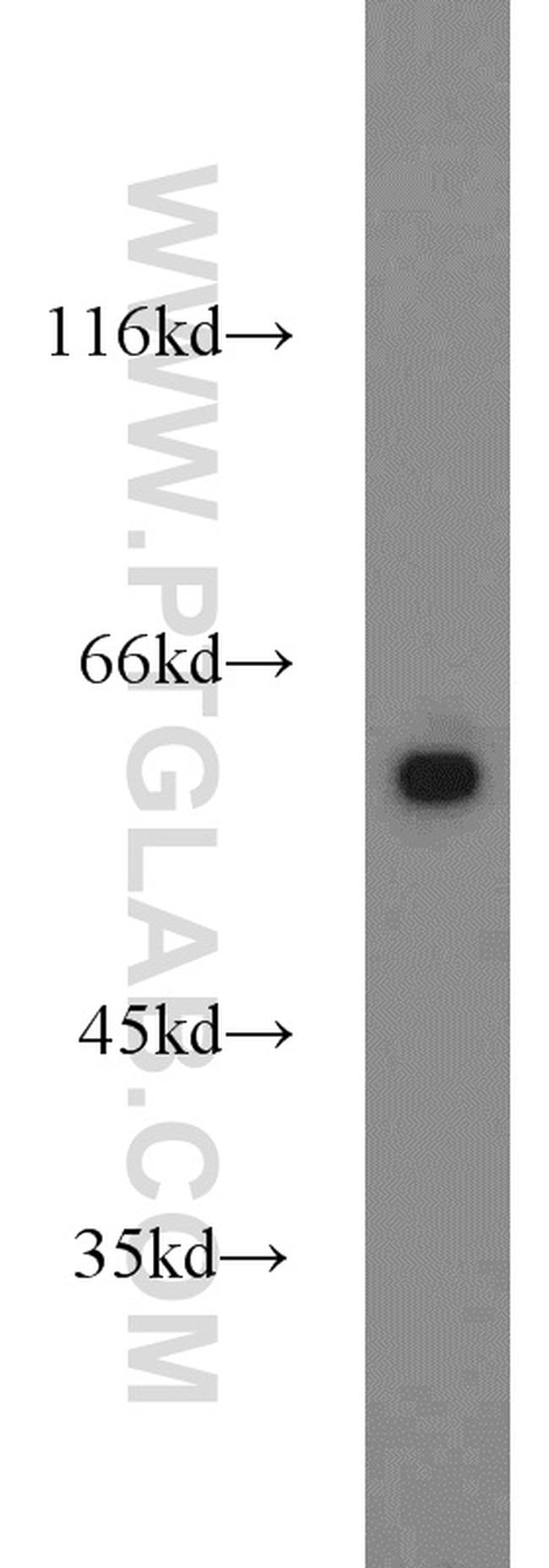 PKM Antibody in Western Blot (WB)