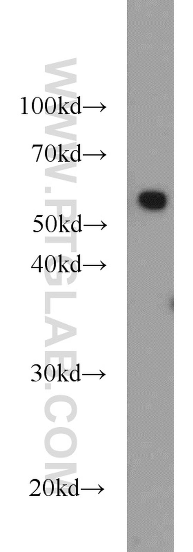 PKM Antibody in Western Blot (WB)