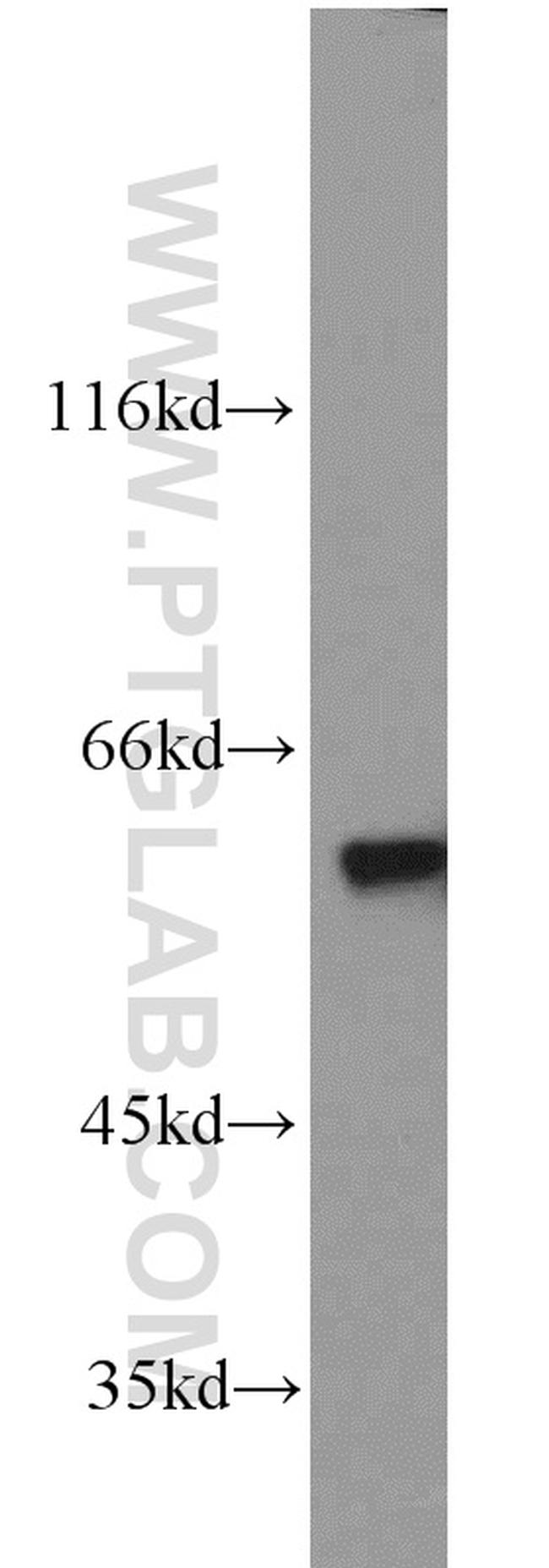 PKM Antibody in Western Blot (WB)