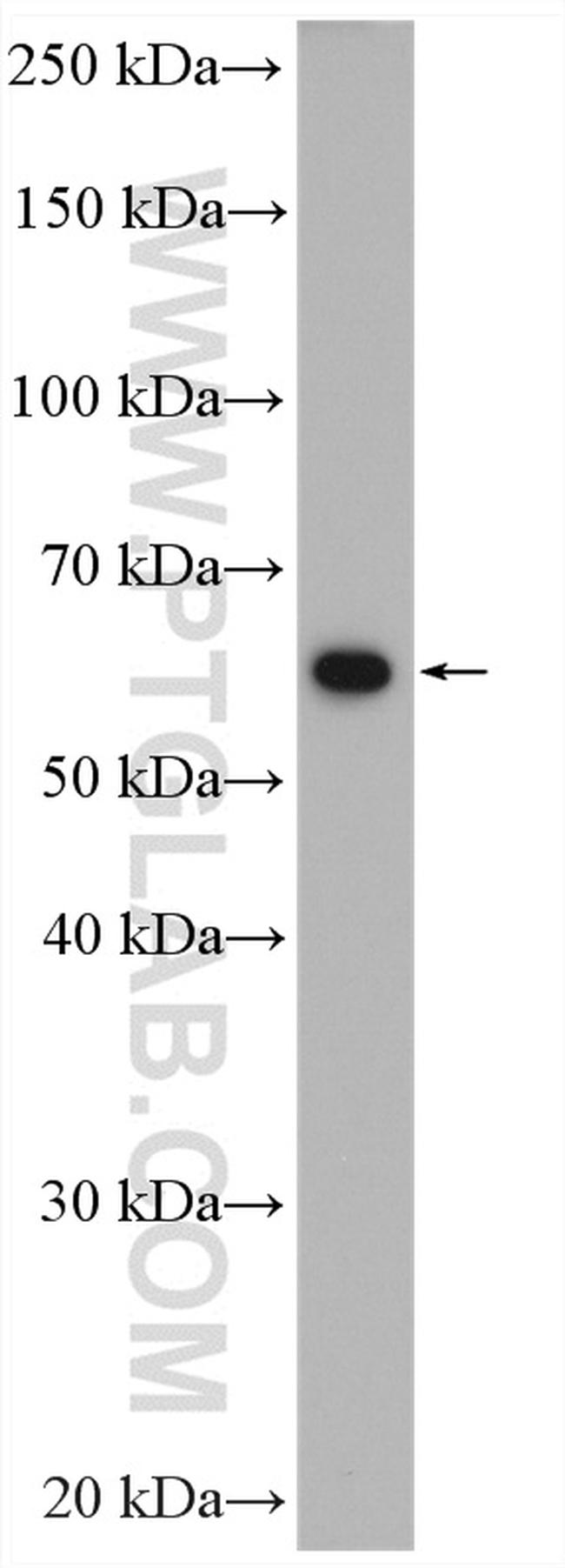 PKM Antibody in Western Blot (WB)