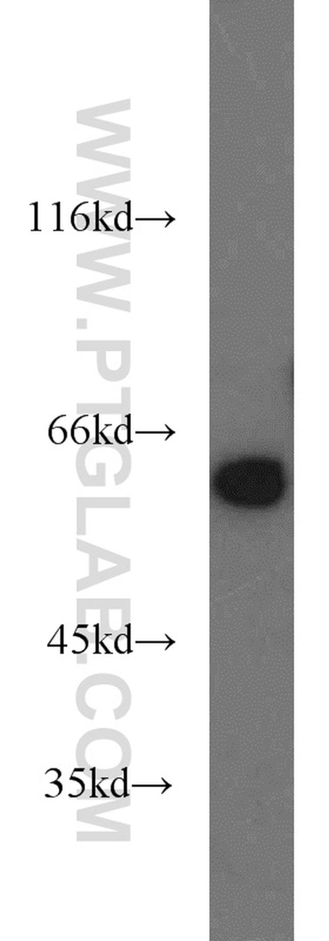 PKM Antibody in Western Blot (WB)