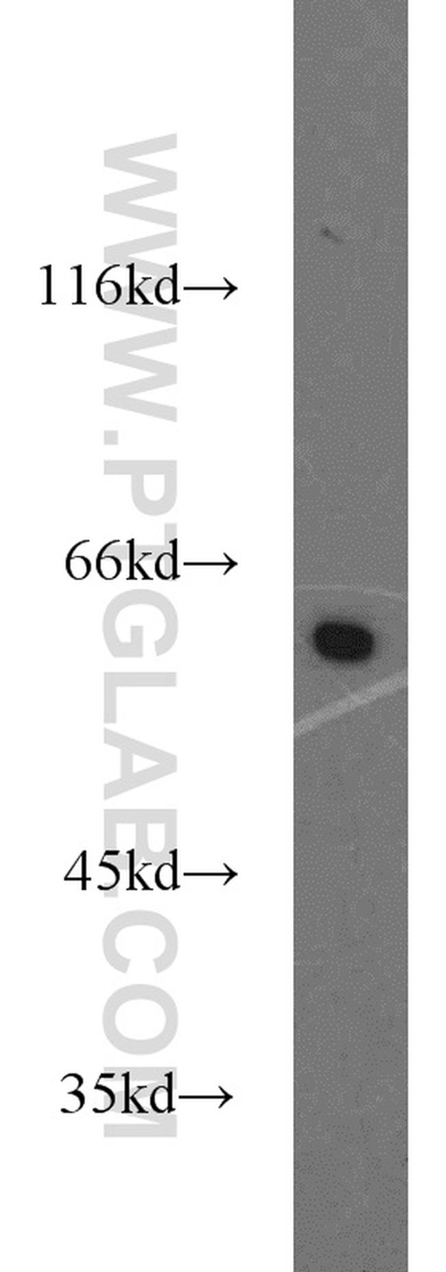 PKM Antibody in Western Blot (WB)