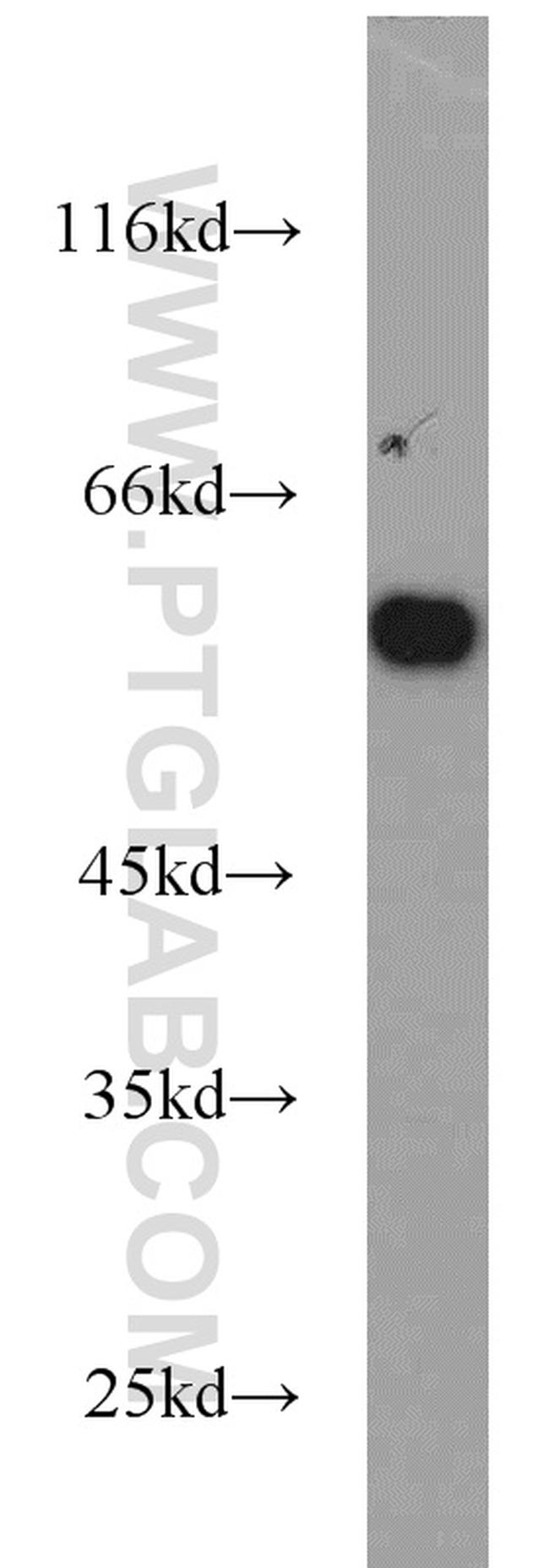 PKM Antibody in Western Blot (WB)