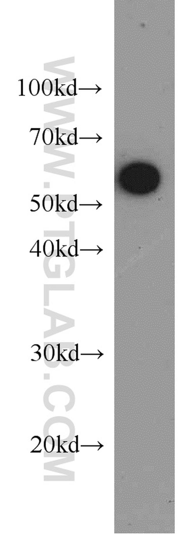 PKM Antibody in Western Blot (WB)