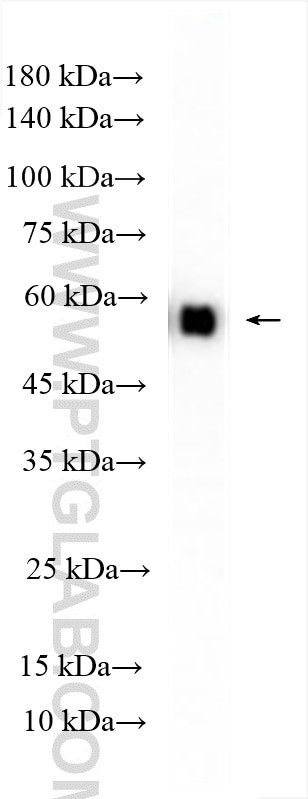 PKM Antibody in Western Blot (WB)