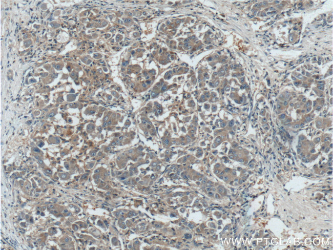 GNB3 Antibody in Immunohistochemistry (Paraffin) (IHC (P))