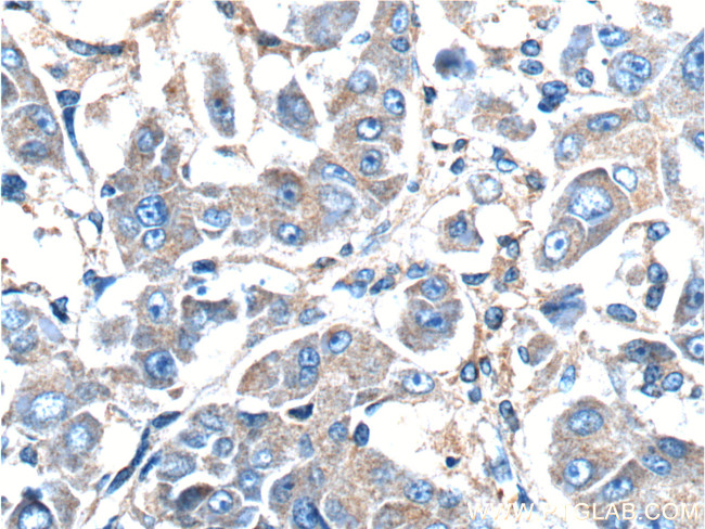 GNB3 Antibody in Immunohistochemistry (Paraffin) (IHC (P))