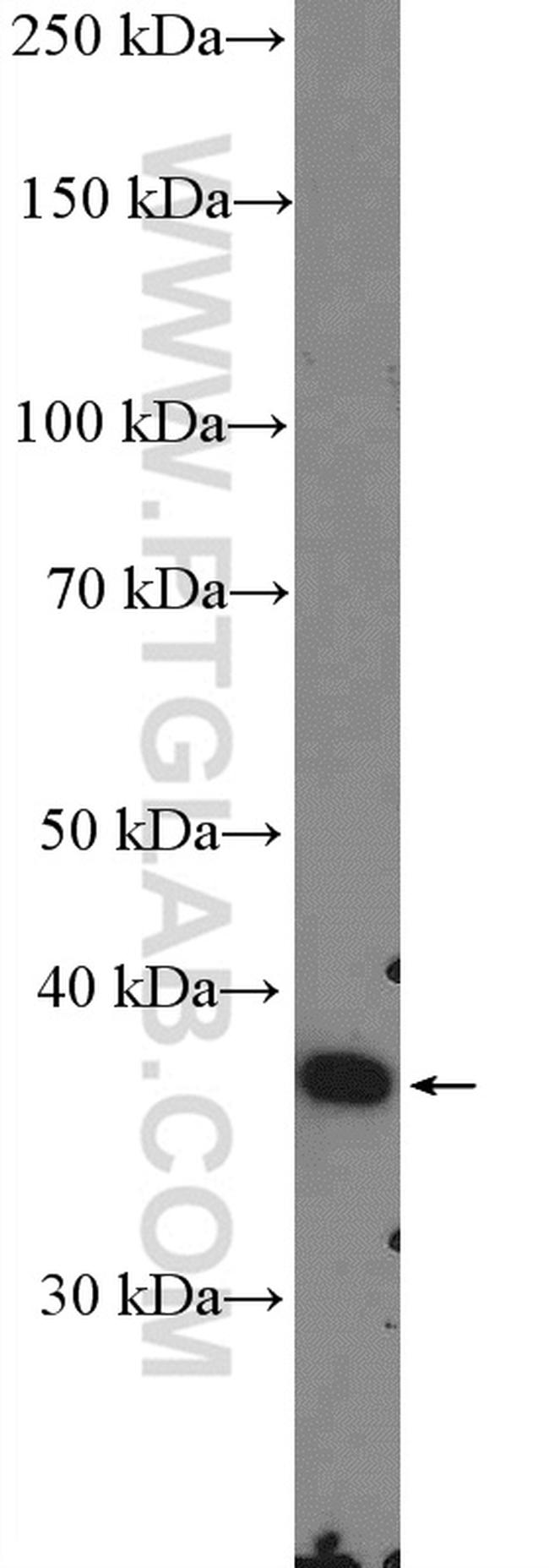 GNB3 Antibody in Western Blot (WB)