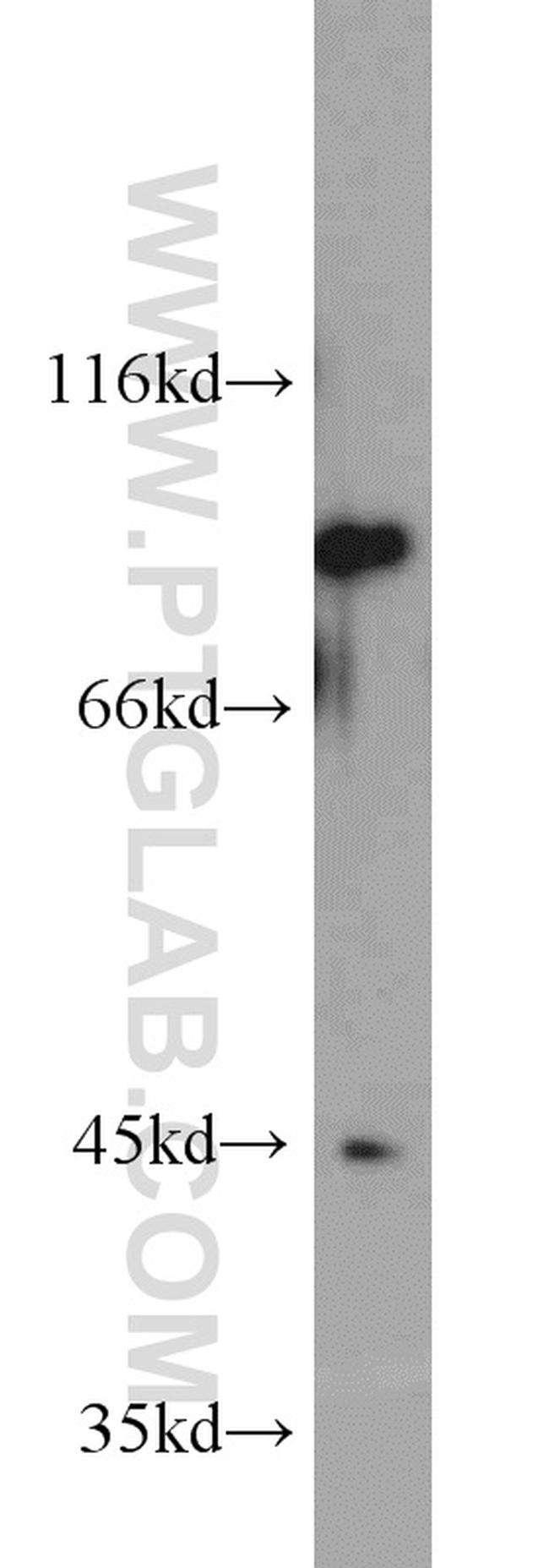 CD71 Antibody in Western Blot (WB)