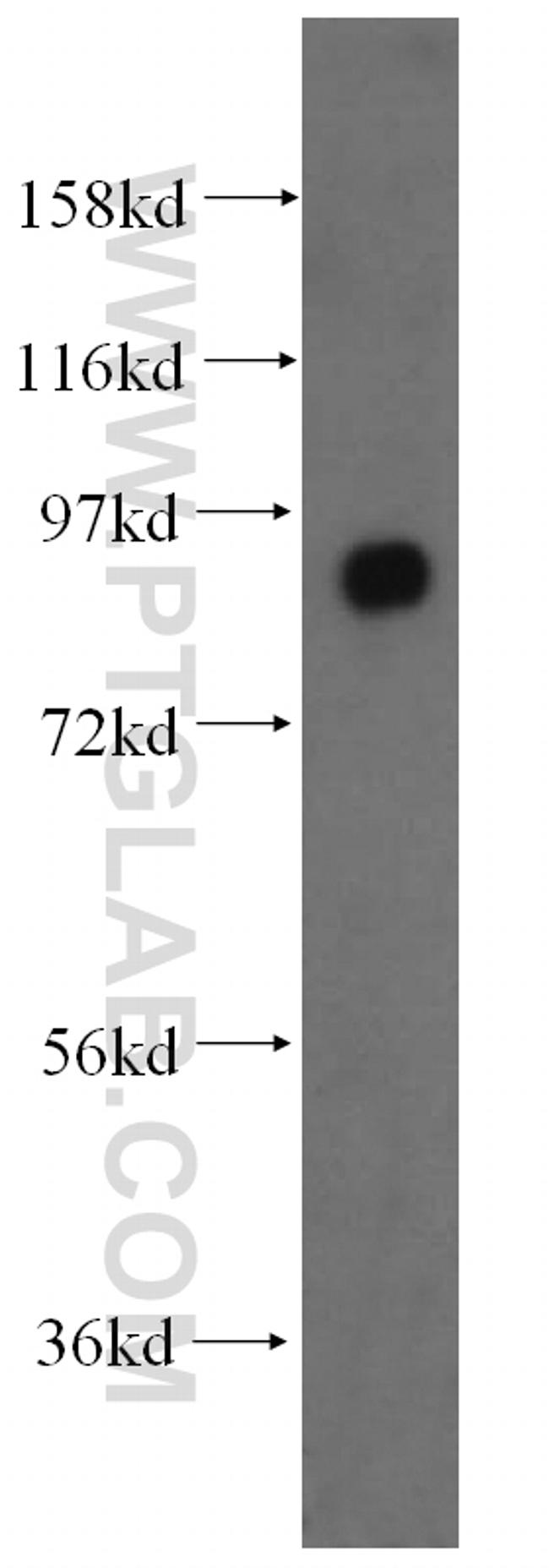 CD71 Antibody in Western Blot (WB)