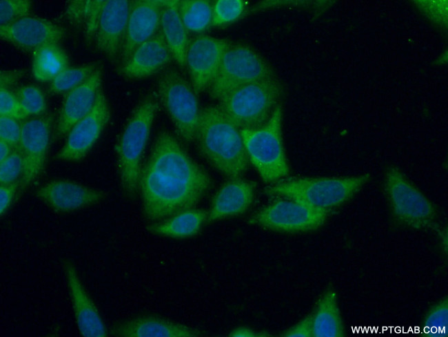 CD71 Antibody in Immunocytochemistry (ICC/IF)