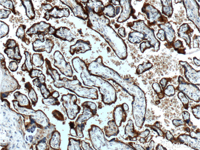 CD71 Antibody in Immunohistochemistry (Paraffin) (IHC (P))