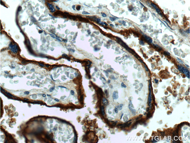 CD71 Antibody in Immunohistochemistry (Paraffin) (IHC (P))