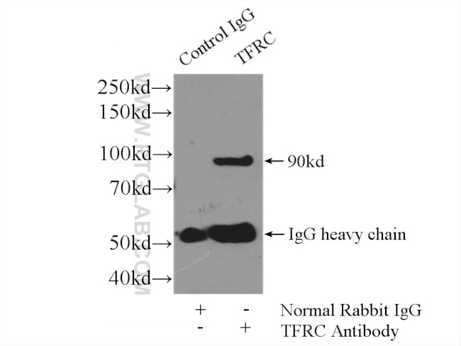 CD71 Antibody in Immunoprecipitation (IP)