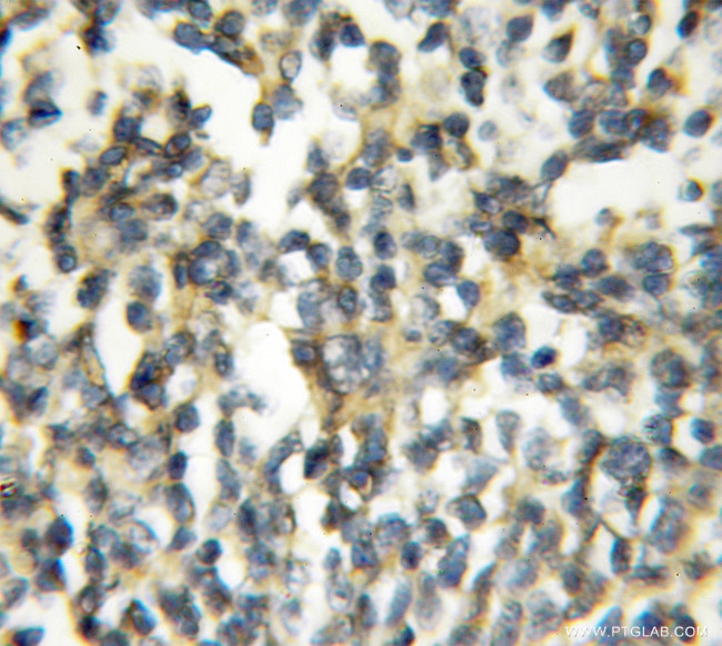 PAFAH2 Antibody in Immunohistochemistry (Paraffin) (IHC (P))