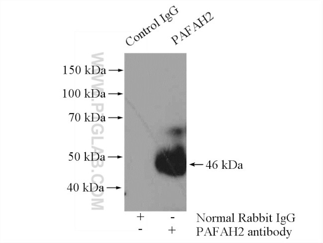 PAFAH2 Antibody in Immunoprecipitation (IP)