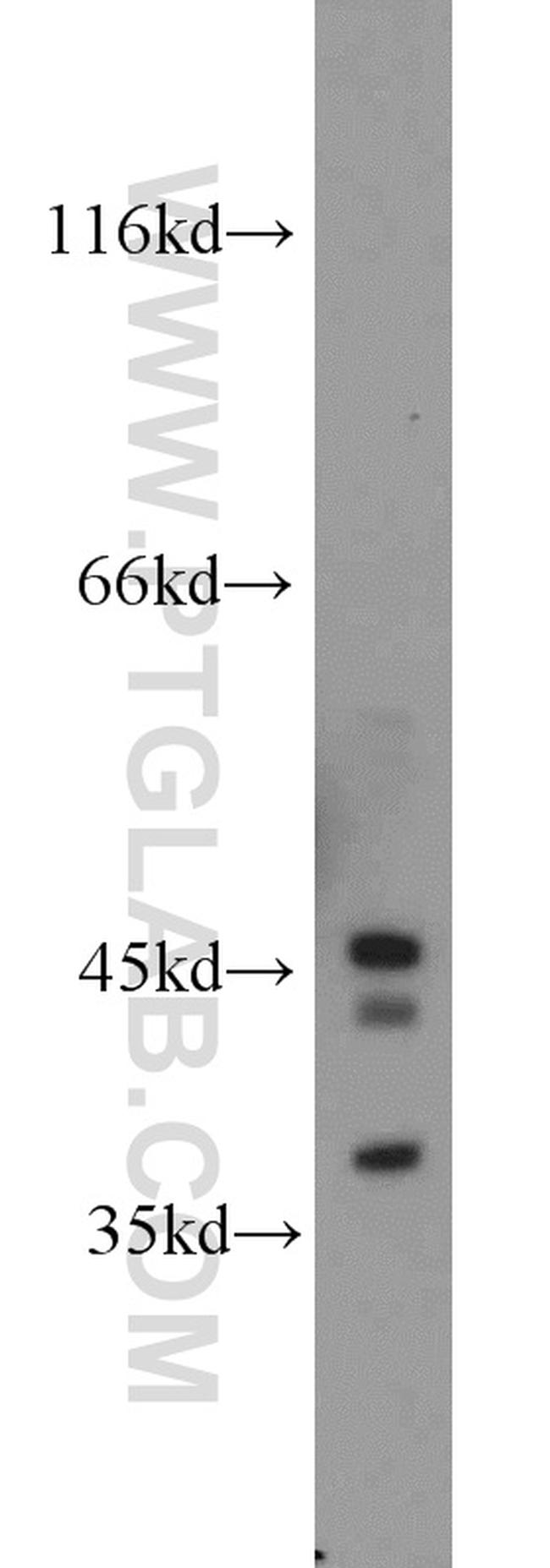 PAFAH2 Antibody in Western Blot (WB)