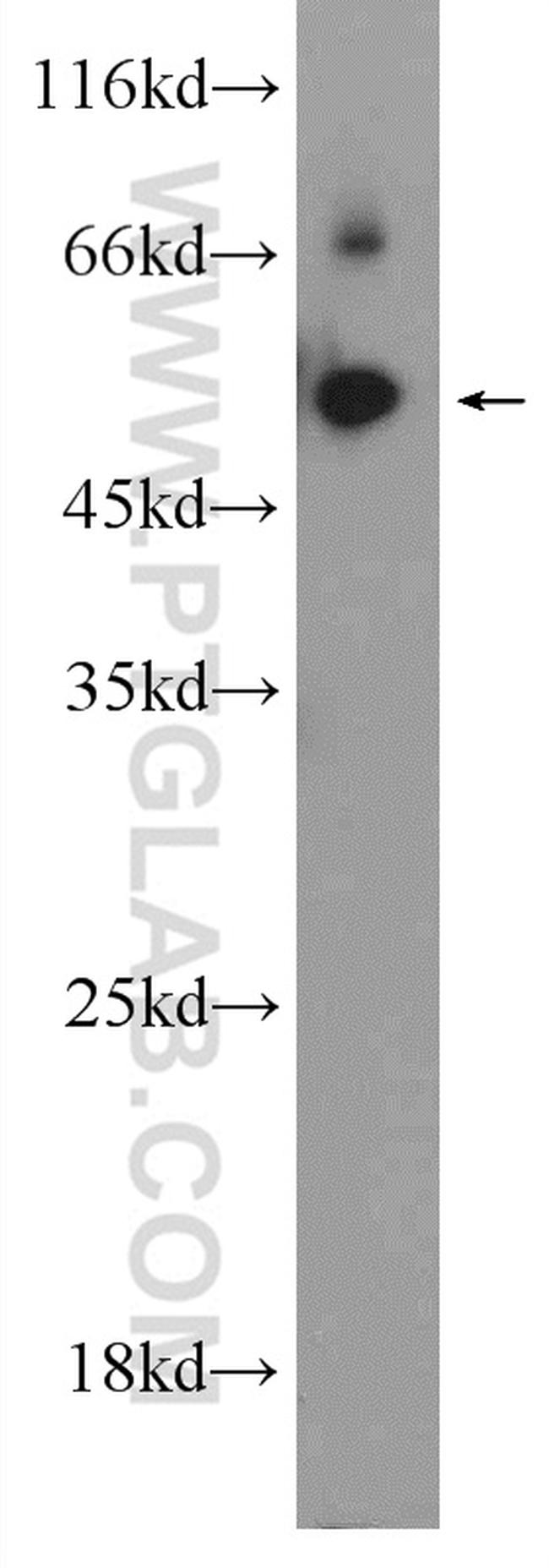 ACVR1B Antibody in Western Blot (WB)