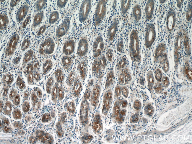 Annexin IV Antibody in Immunohistochemistry (Paraffin) (IHC (P))