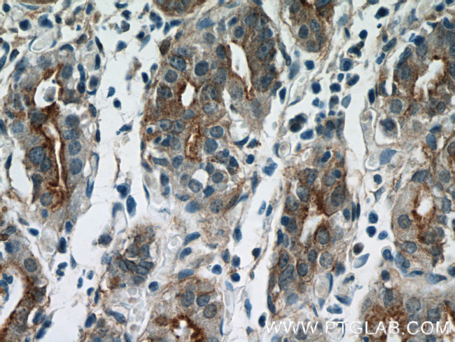 Annexin IV Antibody in Immunohistochemistry (Paraffin) (IHC (P))