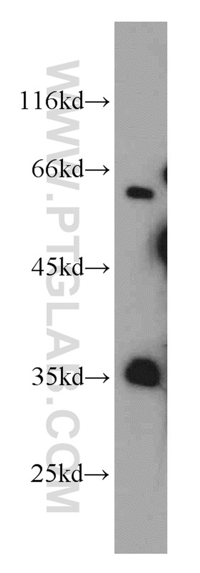 Annexin IV Antibody in Western Blot (WB)