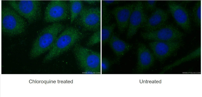 ATG7 Antibody in Immunocytochemistry (ICC/IF)