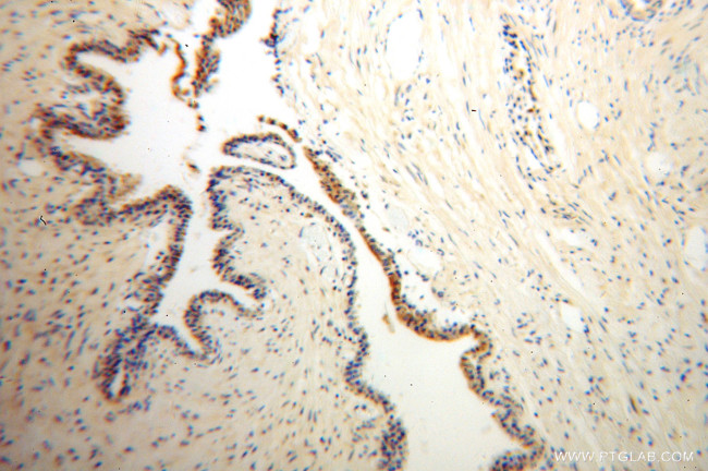 ARL2BP Antibody in Immunohistochemistry (Paraffin) (IHC (P))