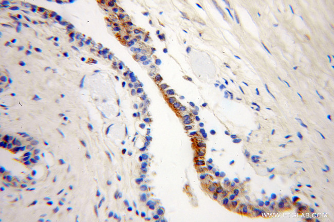 ARL2BP Antibody in Immunohistochemistry (Paraffin) (IHC (P))