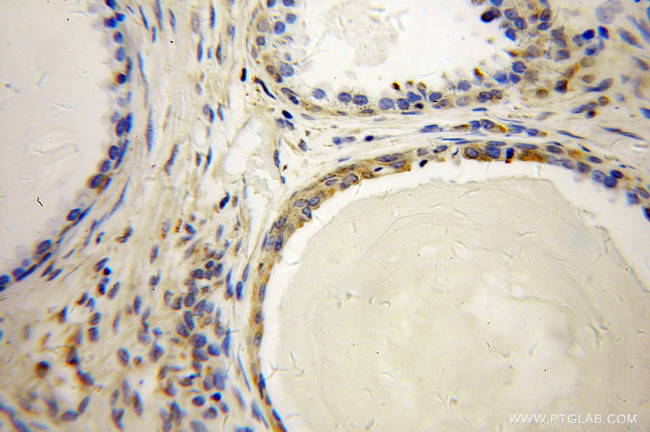 ARL2BP Antibody in Immunohistochemistry (Paraffin) (IHC (P))