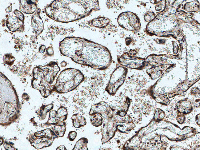 NOB1 Antibody in Immunohistochemistry (Paraffin) (IHC (P))