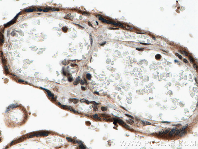 NOB1 Antibody in Immunohistochemistry (Paraffin) (IHC (P))